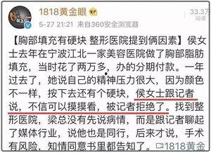 男人发个吃瓜的表情是什么意思,男人发吃瓜表情背后的含义